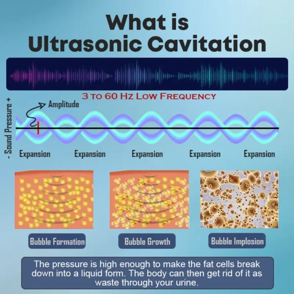 Histone™ Ultrasonic Fat Blasting & Far Infrared Blood Sugar Balancing Detox Wristband