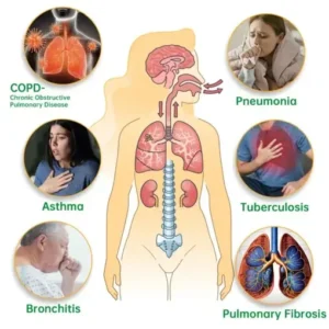 Radianceonehandset™ Lung Mucus Cleansing Inhaler