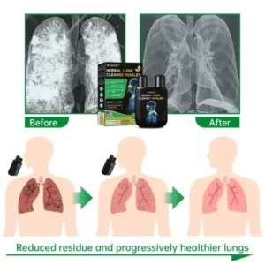 Radianceonehandset™ Lung Mucus Cleansing Inhaler